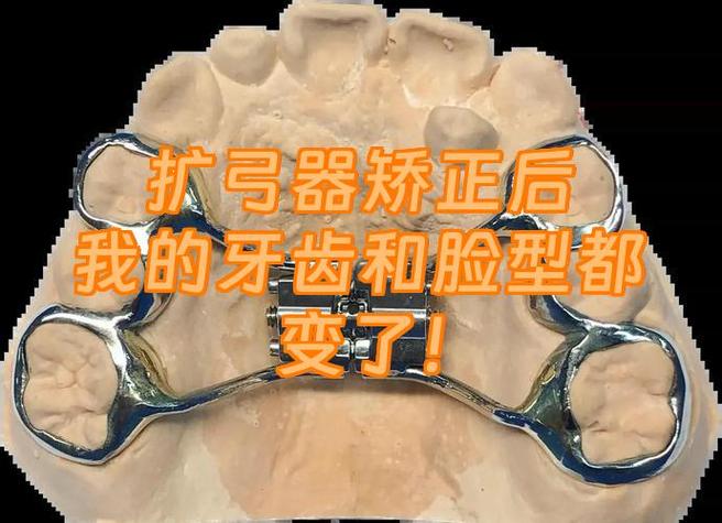 牙齿矫正弊利的原因_16岁矫正牙齿的利与弊_牙齿矫正利大于弊吗