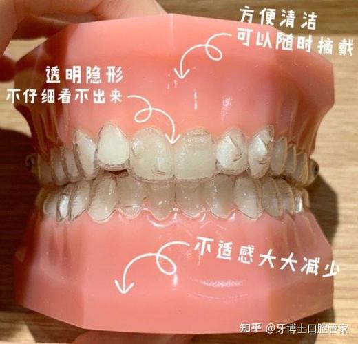 中学生牙齿矫正多少钱_深圳中学生牙齿矫正优惠活动_中学生矫正牙齿需要注意事项