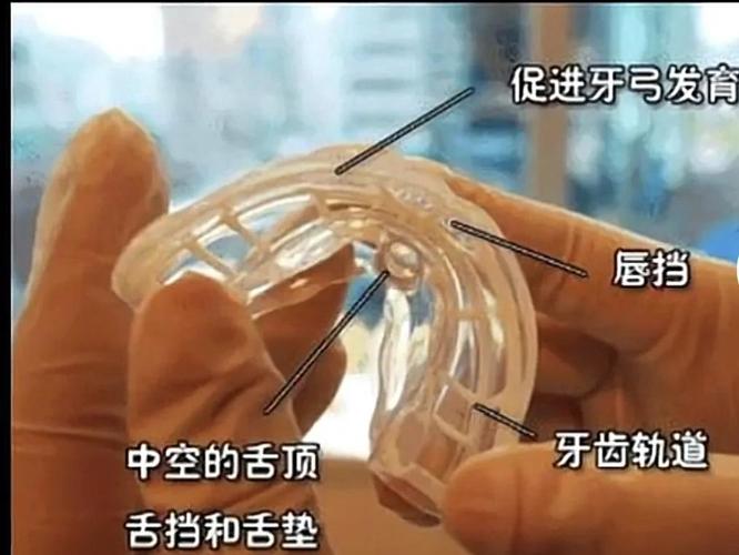 深圳南山儿童隐形MRC矫正费用到底多少钱？