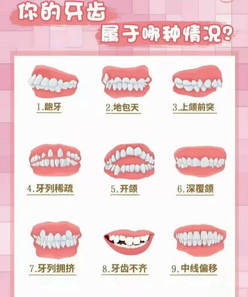 牙齿矫正年龄最佳是几岁_牙齿矫正哪个年龄最好_矫正牙齿的最佳年龄是多少岁
