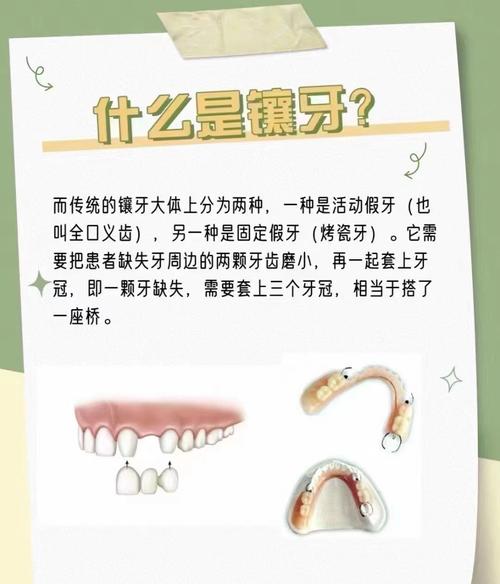 牙齿脱落一颗种牙多少钱_牙齿脱落 种牙_脱落的牙齿可以种回去吗