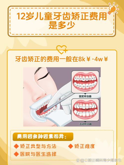 12岁儿童矫正牙齿需要多少钱_矫正牙齿一般要花多少钱儿童_孩子矫正牙齿需要去大医院吗