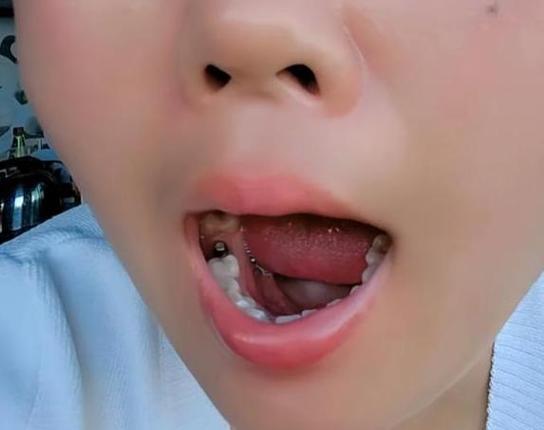 附近有种植牙医院吗_附近种牙_附近哪里种牙最好