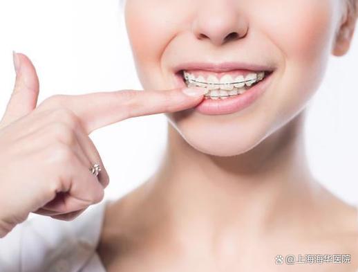 牙齿矫正钱交了不给退怎么办_牙齿矫正钱要一次性付完吗_22岁牙齿矫正多少钱