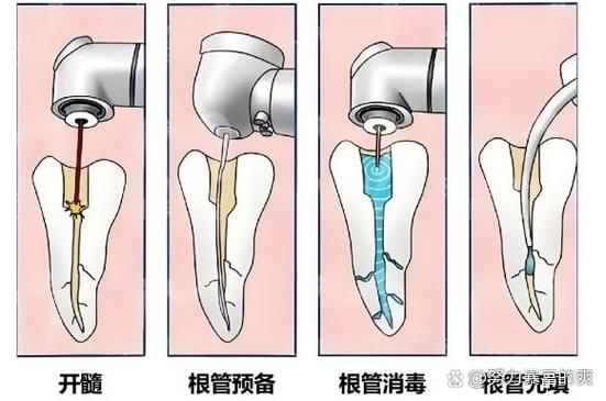 牙术种植深圳检查做前景怎么样_种植牙术前检查多少钱_深圳种植牙术前需要做哪些检查