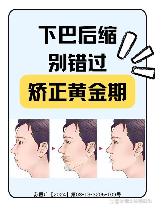 缩下巴牙齿矫正后会反弹吗_矫正牙齿下巴后缩可以改善多少_矫正牙齿下巴后缩