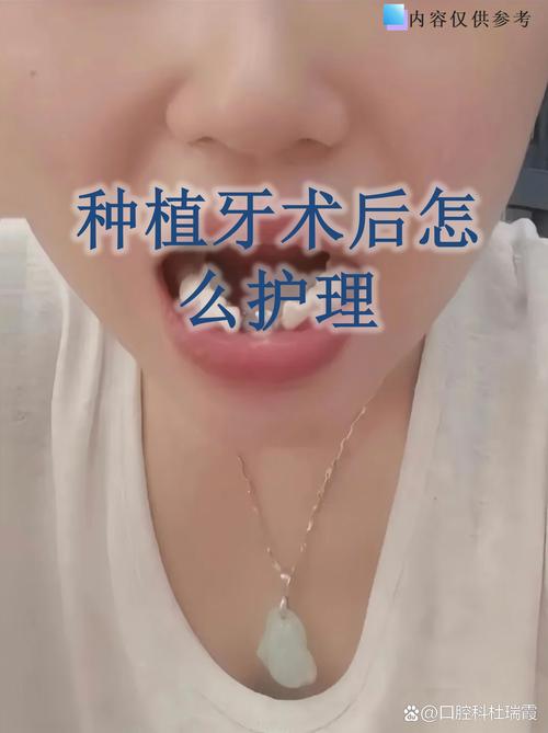 长沙种植牙_长沙牙科种植牙收费价目表_长沙种植牙齿哪个医院最好