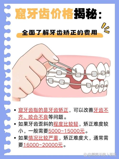 矫正门牙突出需要拔牙吗_门牙突出矫正要多少钱_牙齿矫正门牙突出