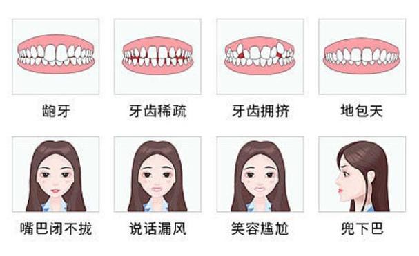 成人牙齿矫正表价格怎么算_成人矫正牙齿的价格表_成人牙齿矫正