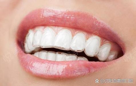 矫正牙齿现在牙好松动的_松动牙齿矫正牙好现在还疼_牙齿矫正松动后还能恢复以前吗