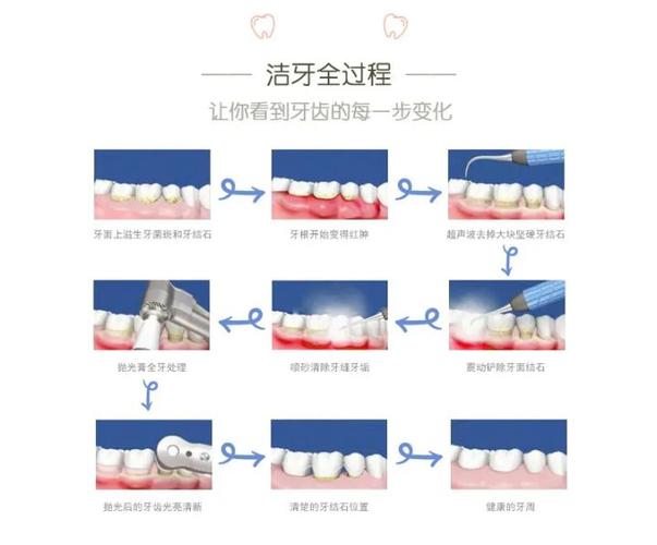 深圳宝安隐适美正品认证医院怎么选？