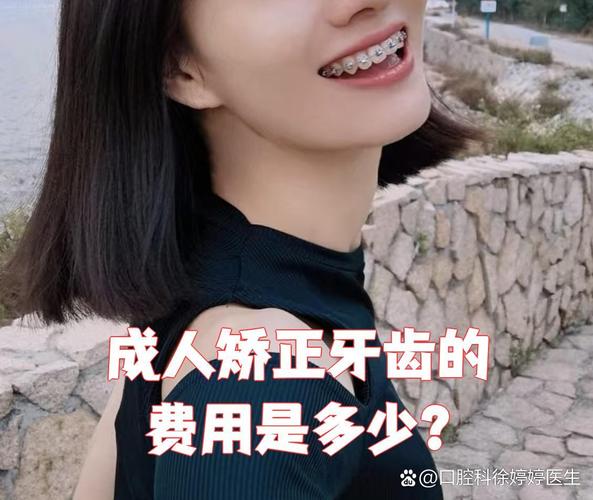 深圳龙华牙齿不齐钢丝矫正费用_矫正牙齿的钢丝贵吗_牙齿矫正钢丝价格