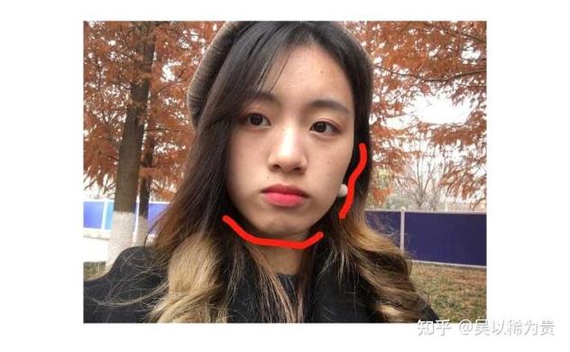 莲塘小孩正畸多少钱？费用明细和避坑指南