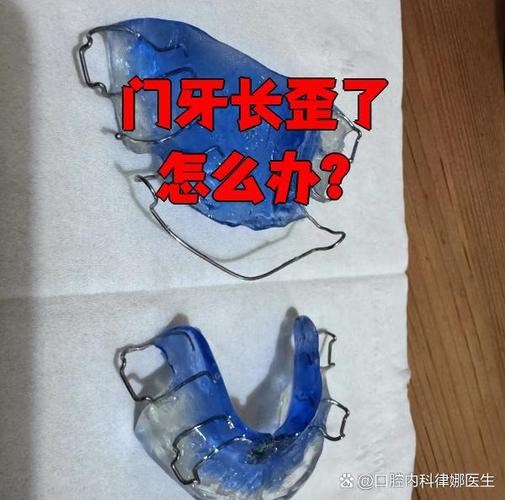 长歪的牙能矫正吗_长歪的牙齿怎样纠正_长歪的牙齿能自己长正吗
