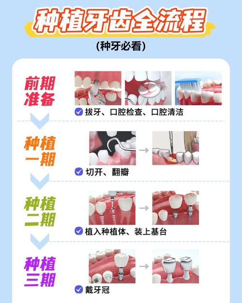 附近牙科种牙_附近种植牙科_附近哪个医院能种牙治疗