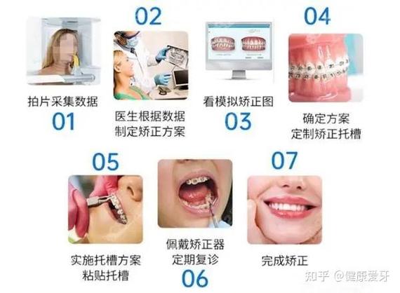 牙齿矫正小孩_牙齿矫正儿童可以做吗_儿童牙齿几岁可以矫正