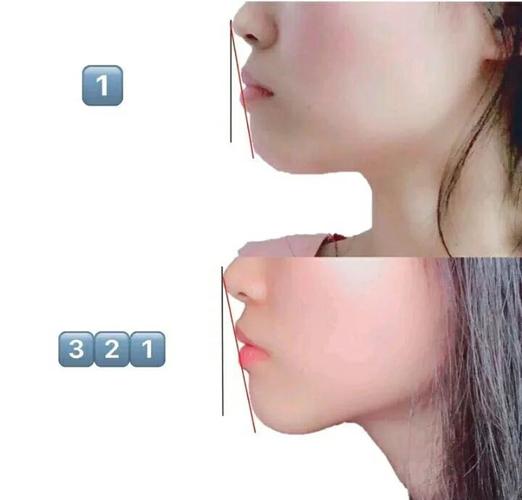 34岁做龅牙矫正还来得及吗？我的真实感受