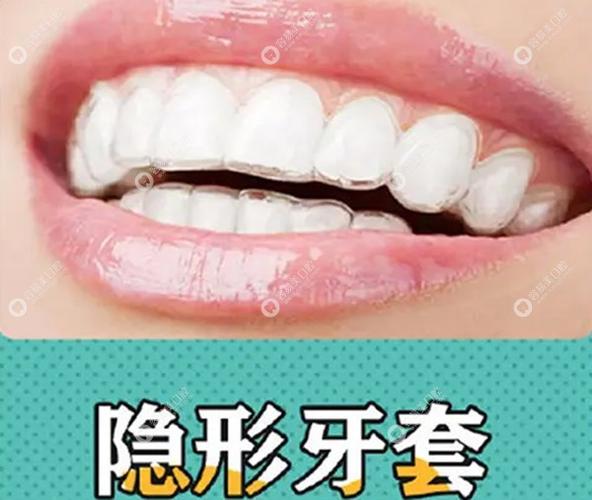 深圳隐适美价格_深圳隐适美医生_深圳隐适美隐形矫正价格明细