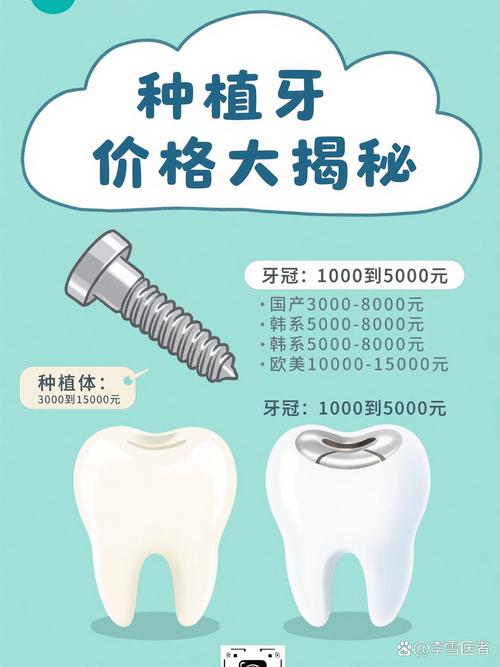 奥齿泰种牙贵不贵？一颗的价格究竟是多少？看完这篇就知道！
