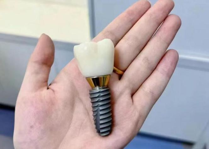 赣州牙齿种植_赣州种牙价格是多少_赣州种植牙医院排名 公立私立对比