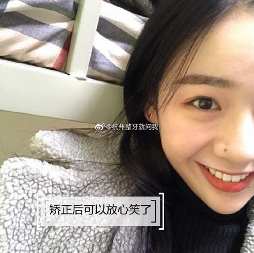深圳隐适美矫正大概多少钱_深圳宝安隐适美正品认证医院_深圳隐适美