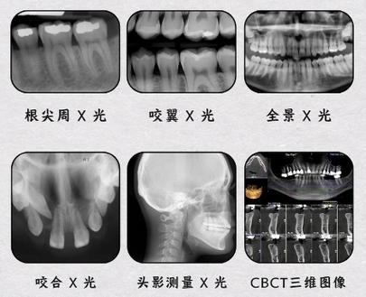 深圳种牙价位_牙种植深圳价格多少_深圳种植牙价格