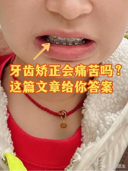 19岁还能做牙齿矫正_牙齿矫正还能做ct吗_牙齿矫正还能做磁共振吗