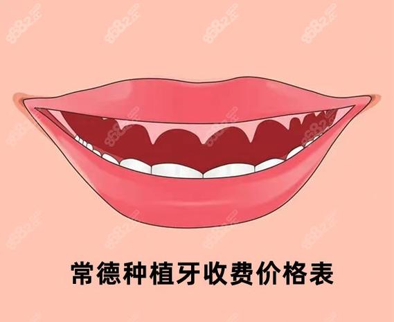 常德半口种植牙费用2026大概多少钱？真实价格参考